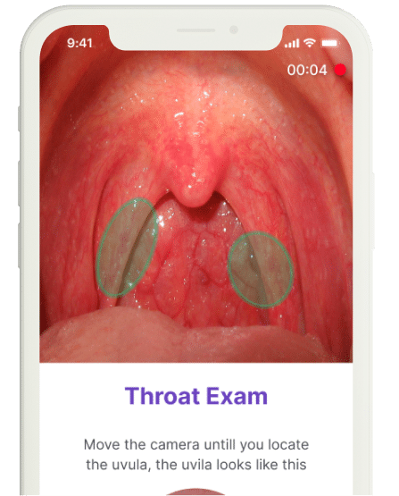 throat exam